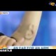 گوش سوم روی ساعد یک پروفسور استرالیایی!