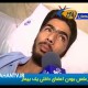 برعکس بودن اعضای داخلی یک بیمار